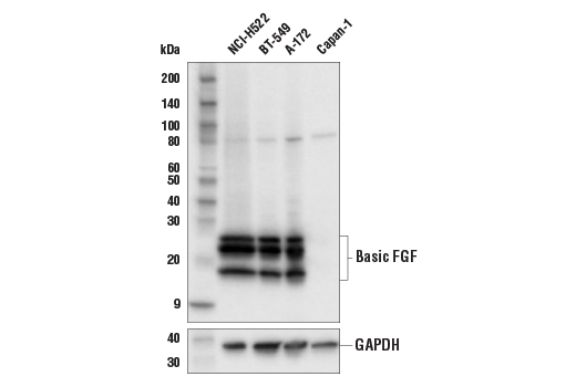  Image 11: Cancer-associated Growth Factor Antibody Sampler Kit