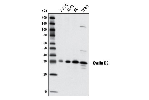  Image 1: Cyclin Antibody Sampler Kit