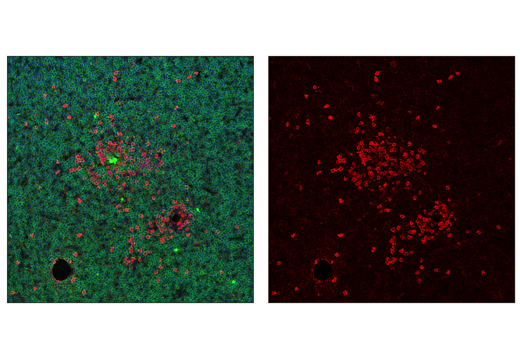 Immunofluorescence Image 2: CD20 Antibody