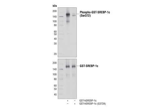 Western Blotting Image 1: Phospho-SREBP-1c (Ser372) Antibody