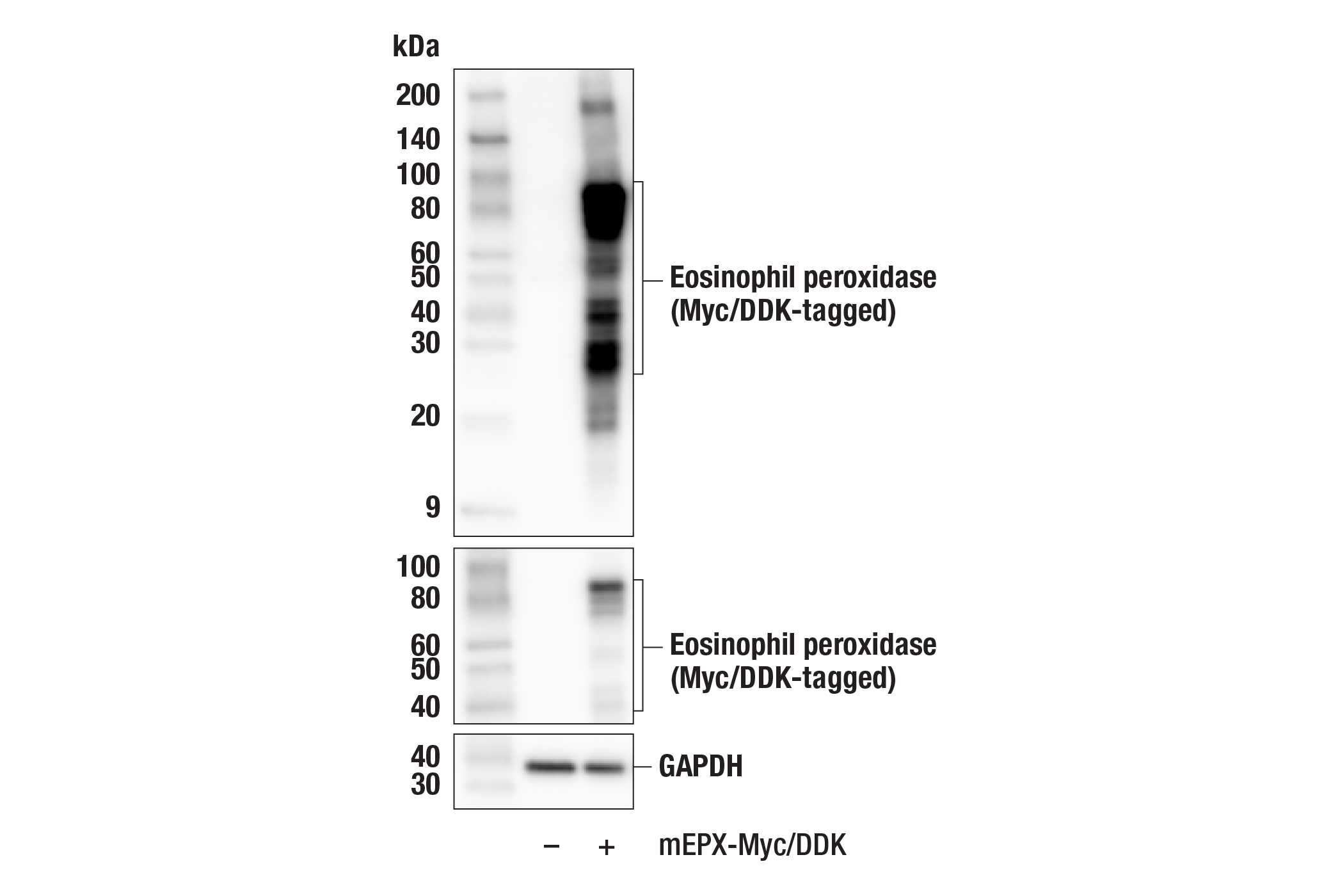 Western Blotting Image 3: Eosinophil peroxidase (F3C2H) Rabbit Monoclonal Antibody