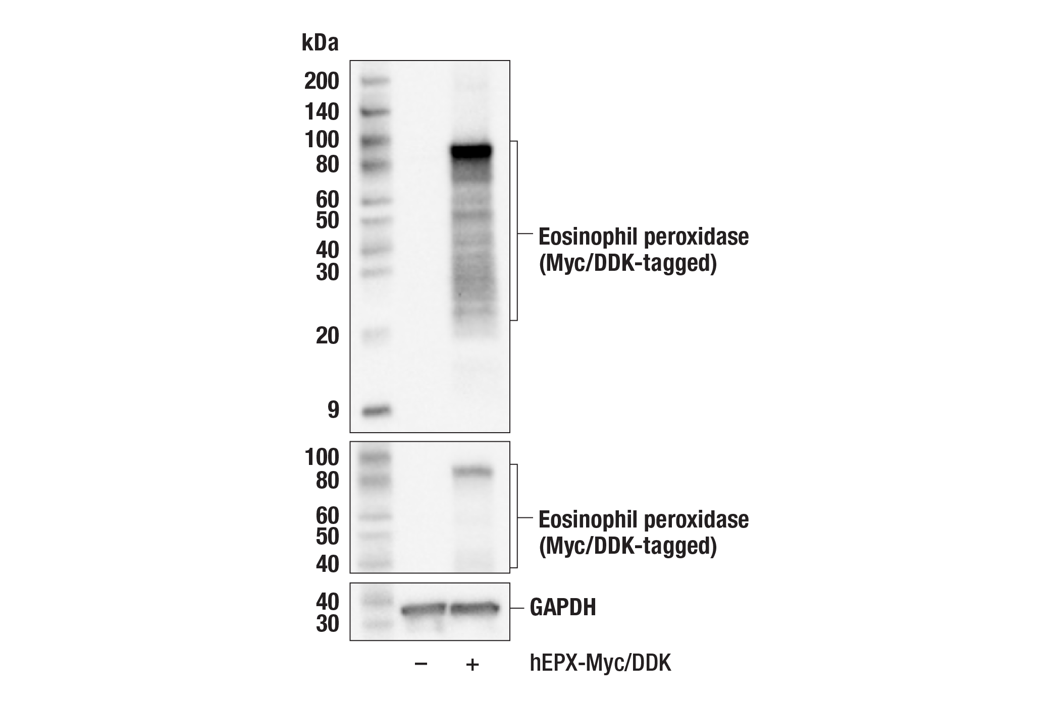 Western Blotting Image 2: Eosinophil peroxidase (F3C2H) Rabbit Monoclonal Antibody