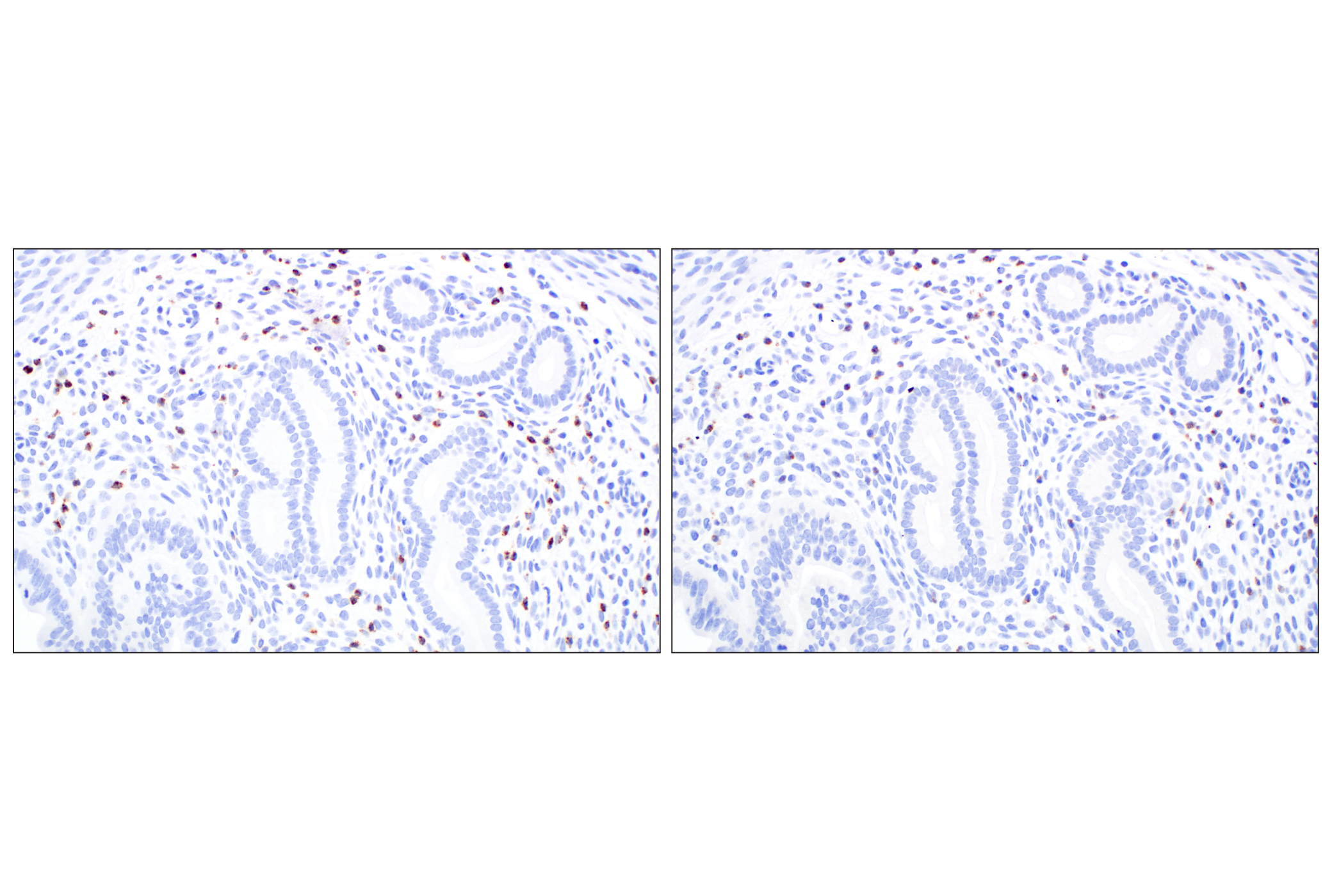 Immunohistochemistry Image 8: Eosinophil peroxidase (F3C2H) Rabbit Monoclonal Antibody