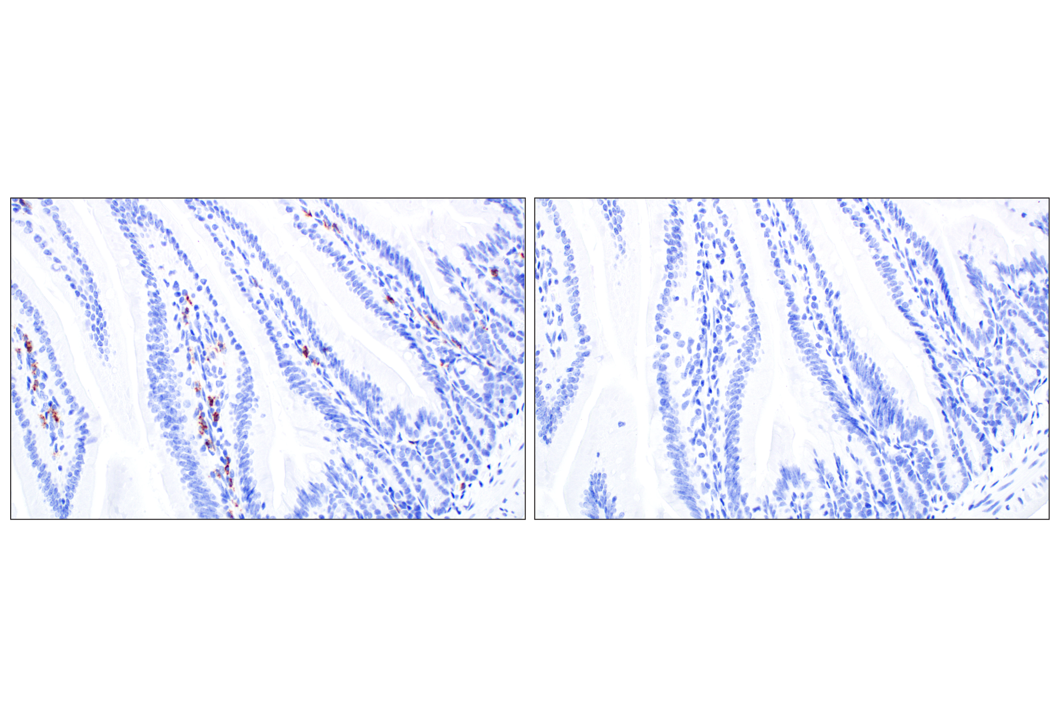 Immunohistochemistry Image 9: Eosinophil peroxidase (F3C2H) Rabbit Monoclonal Antibody