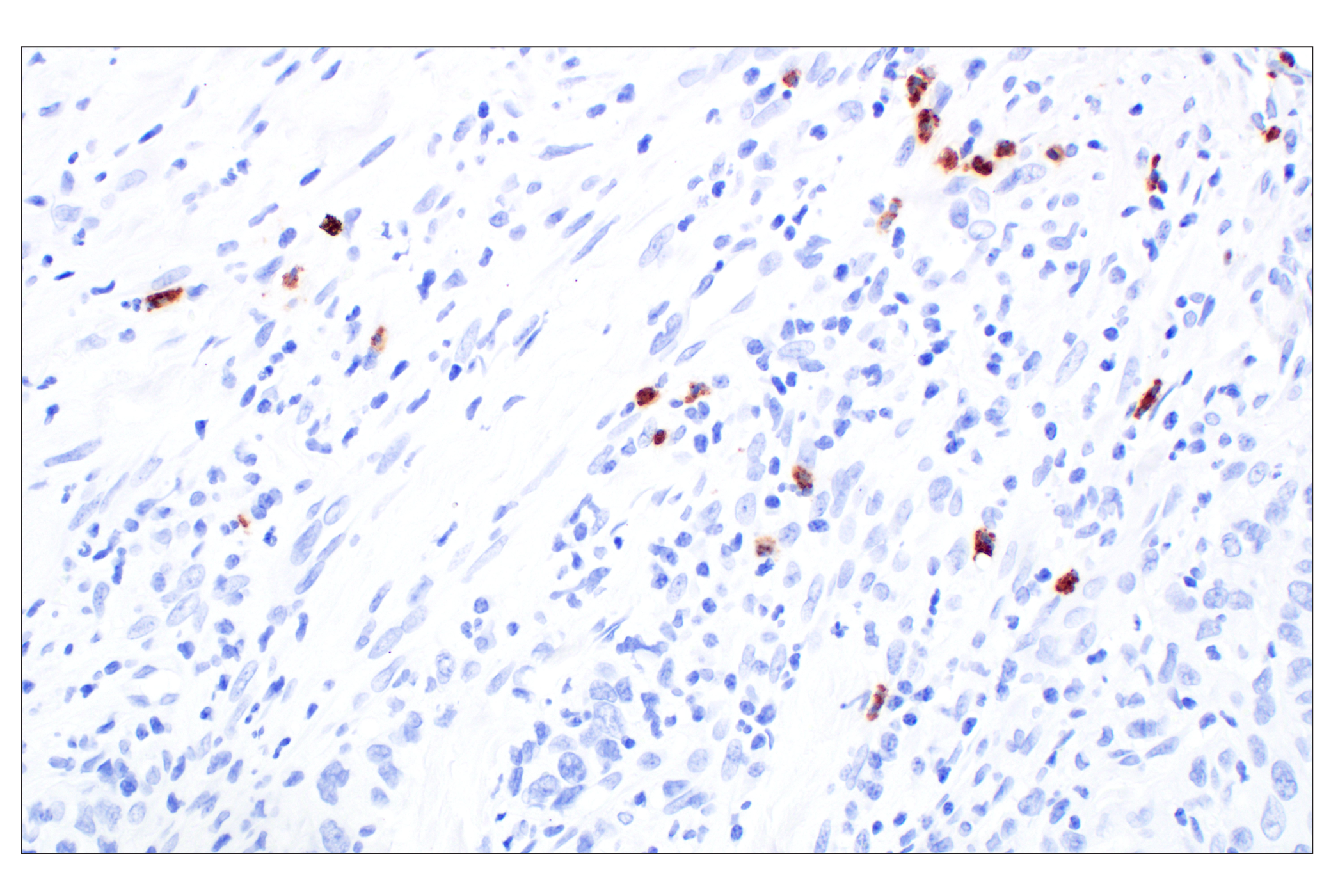 Immunohistochemistry Image 3: Eosinophil peroxidase (F3C2H) Rabbit Monoclonal Antibody