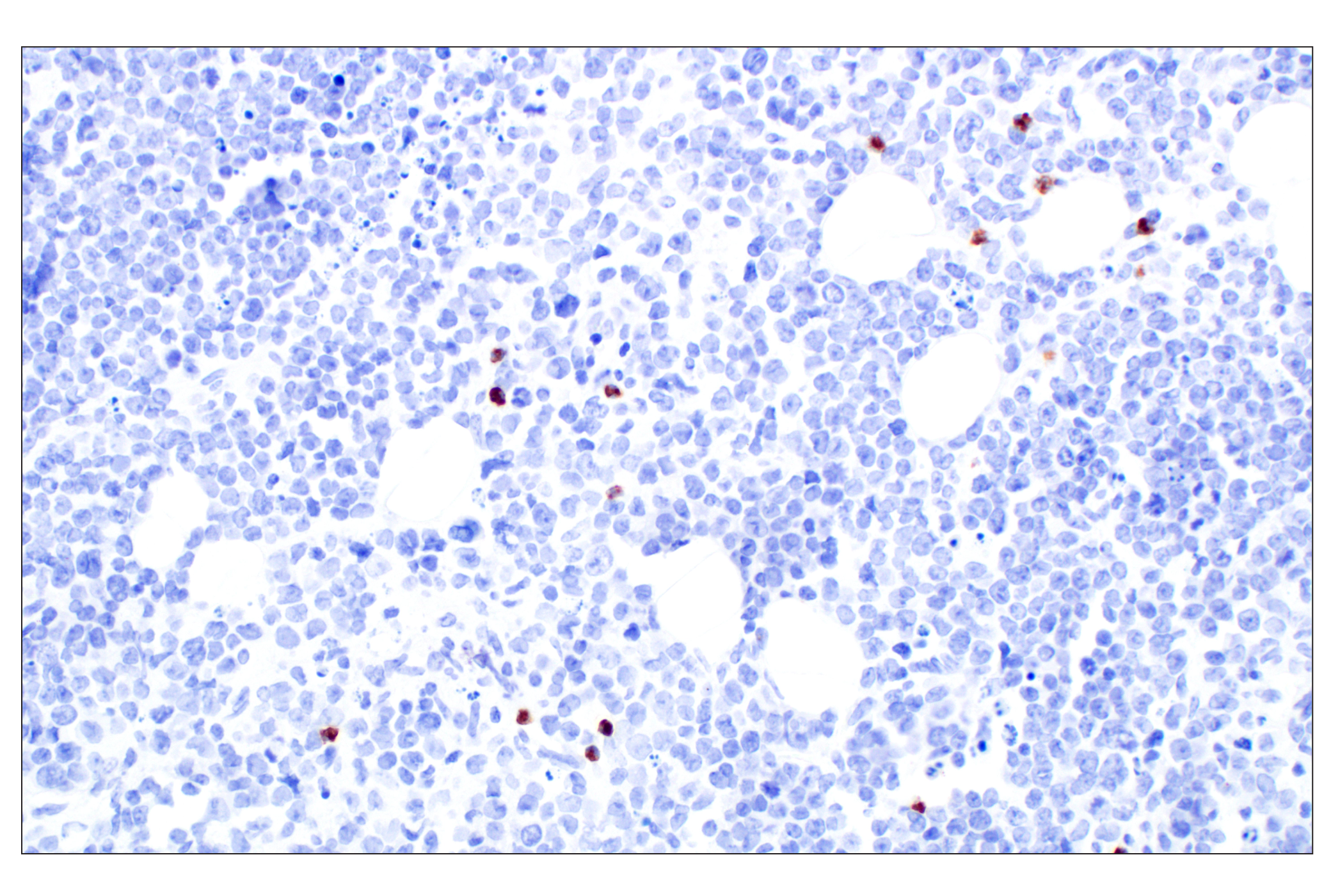 Immunohistochemistry Image 4: Eosinophil peroxidase (F3C2H) Rabbit Monoclonal Antibody