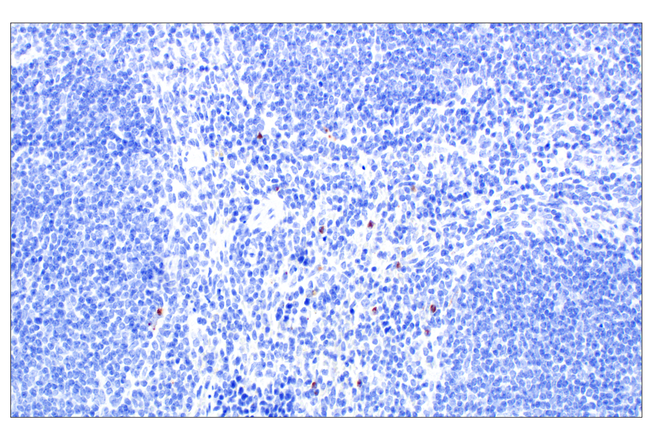 Immunohistochemistry Image 7: Eosinophil peroxidase (F3C2H) Rabbit Monoclonal Antibody