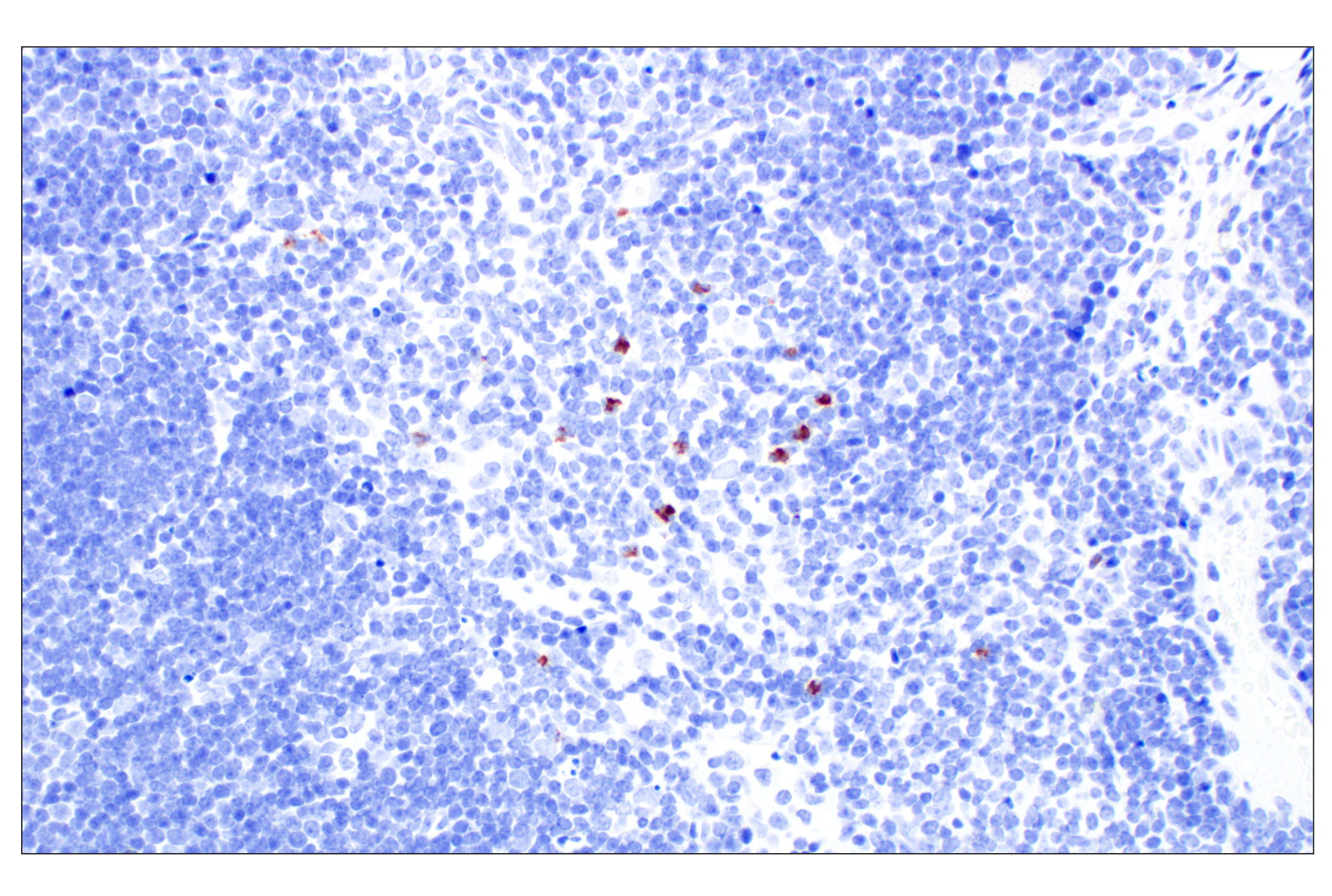 Immunohistochemistry Image 5: Eosinophil peroxidase (F3C2H) Rabbit Monoclonal Antibody