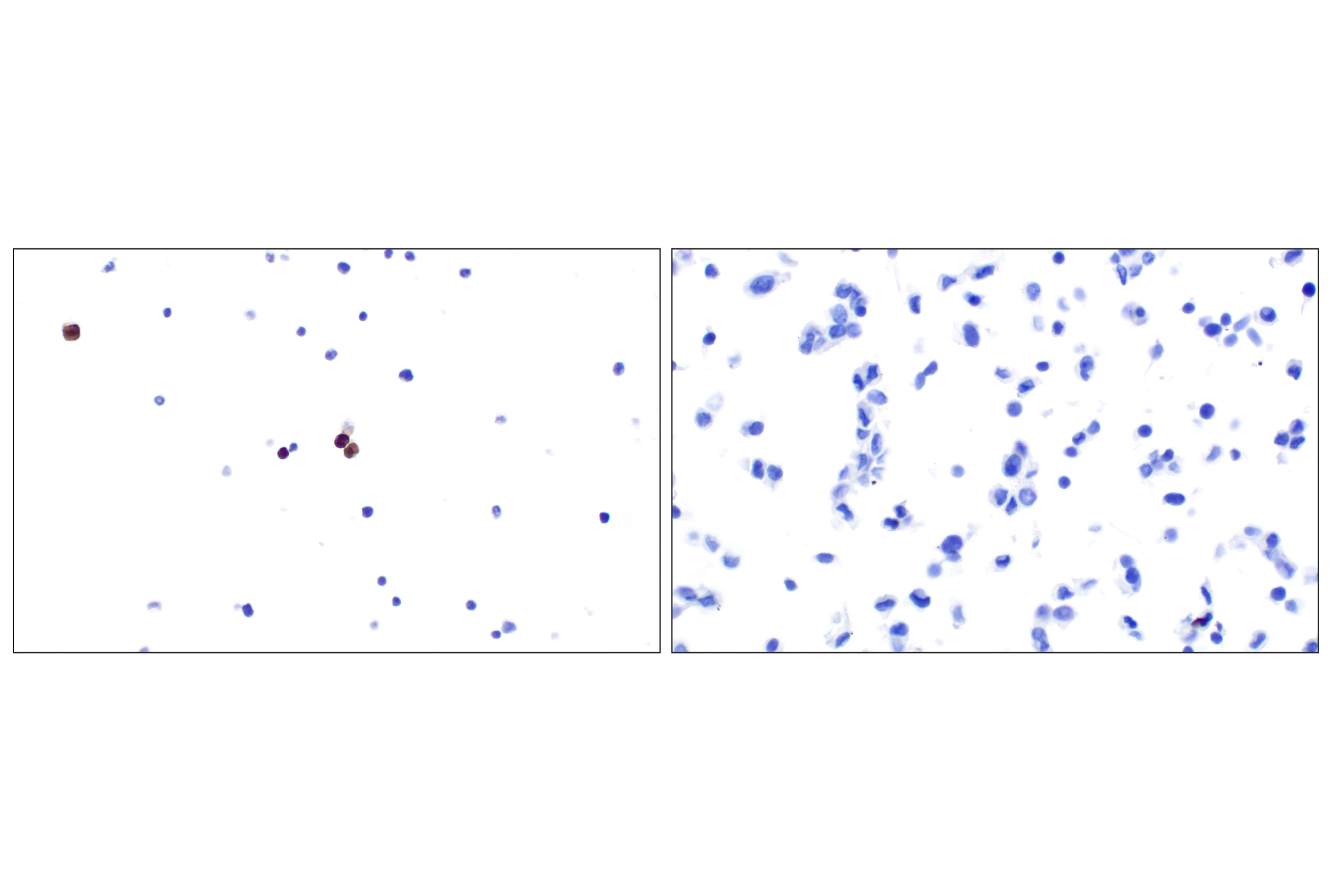 Immunohistochemistry Image 11: Eosinophil peroxidase (F3C2H) Rabbit Monoclonal Antibody