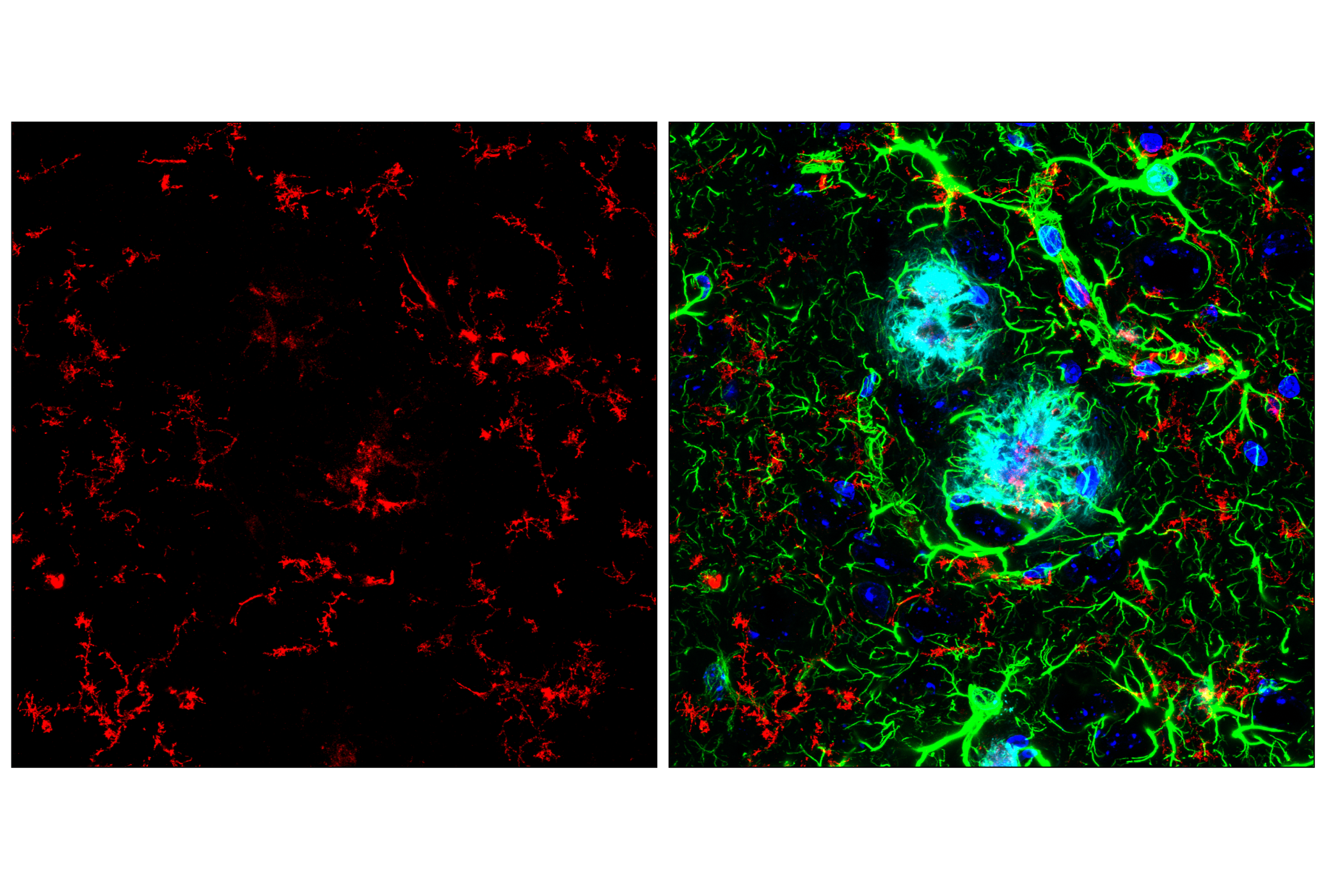 Immunofluorescence Image 1: TMEM119 (E4B9S) Mouse mAb