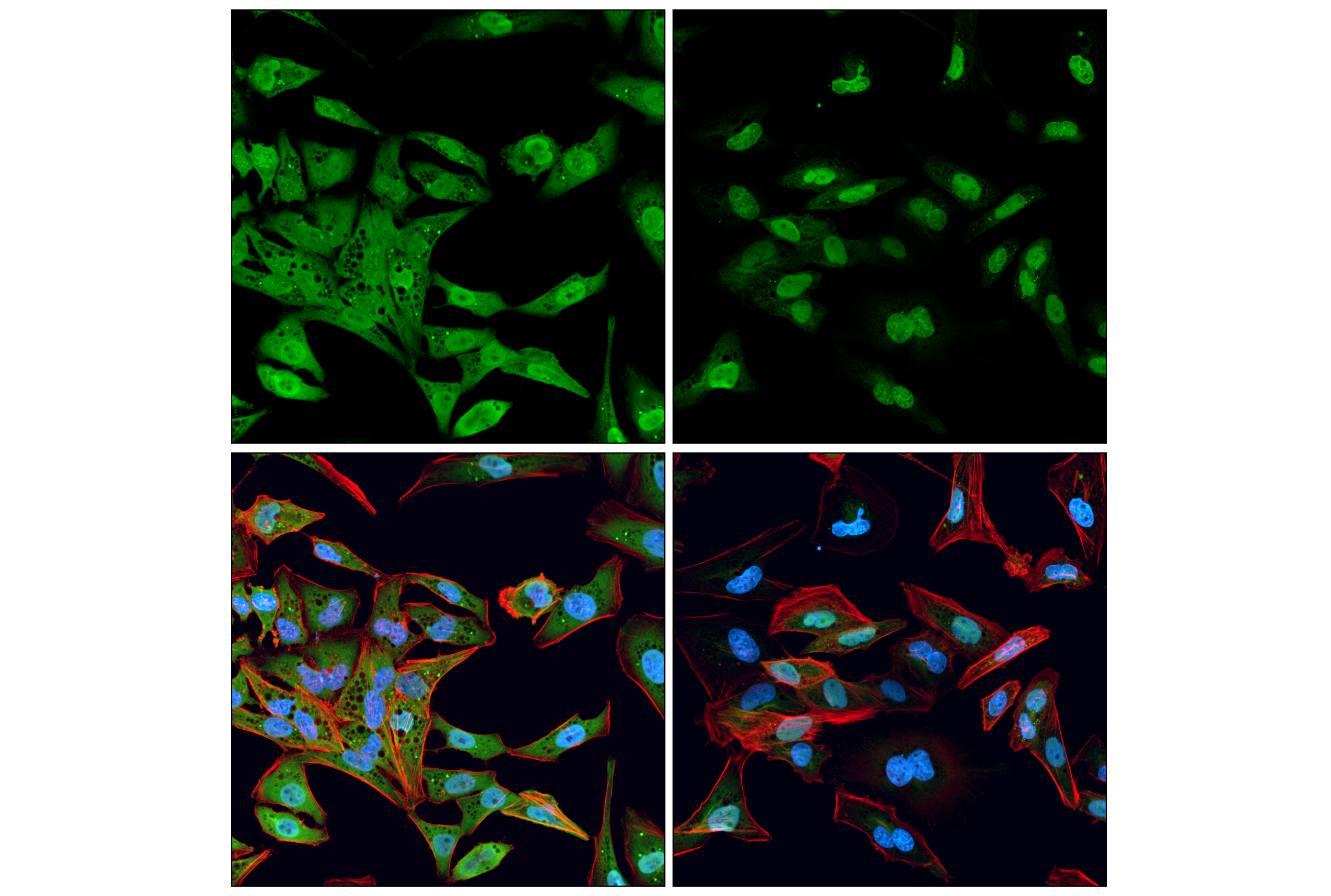 Immunofluorescence Image 1: BAF (E4O8R) Rabbit mAb
