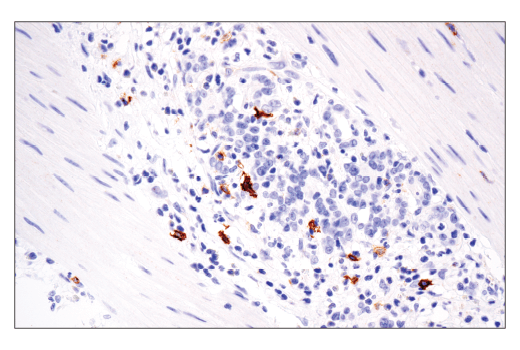Immunohistochemistry Image 1: OX40 (ACT35) Mouse mAb