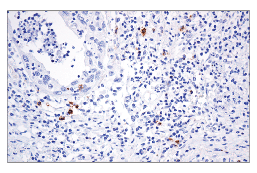 Immunohistochemistry Image 4: OX40 (ACT35) Mouse mAb