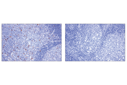 Immunohistochemistry Image 5: OX40 (ACT35) Mouse mAb