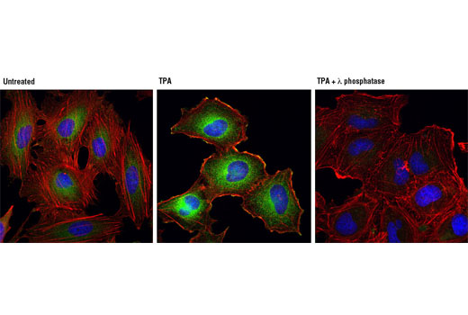 Immunofluorescence Image 1: Phospho-Numb (Ser276) (D5C2) Rabbit mAb