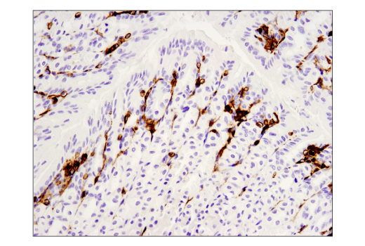 Immunohistochemistry Image 3: CD45 (D3F8Q) Rabbit mAb (BSA and Azide Free)