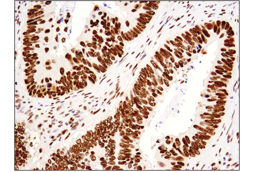 Immunohistochemistry Image 1: Brg1 (E8V5B) Mouse mAb (BSA and Azide Free)