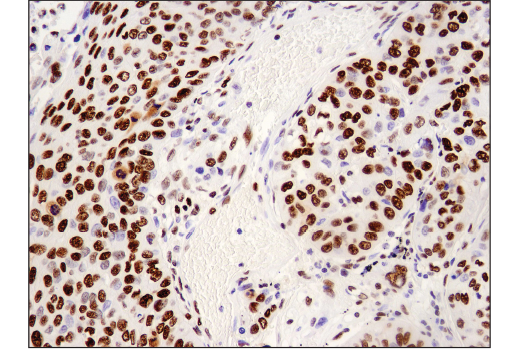 Immunohistochemistry Image 2: Brg1 (E8V5B) Mouse mAb (BSA and Azide Free)