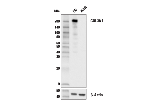 Western Blotting Image 1: COL3A1 (E8D7R) XP® Rabbit mAb (BSA and Azide Free)