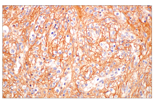 Immunohistochemistry Image 9: COL3A1 (E8D7R) XP® Rabbit mAb (BSA and Azide Free)