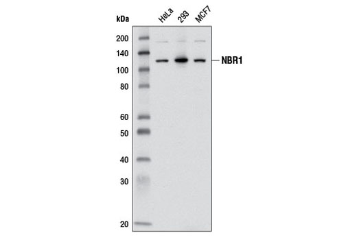  Image 6: SQSTM1/p62-like Receptor Antibody Sampler Kit