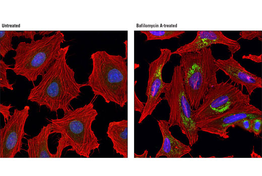 Immunofluorescence Image 1: NBR1 (D2E6) Rabbit mAb