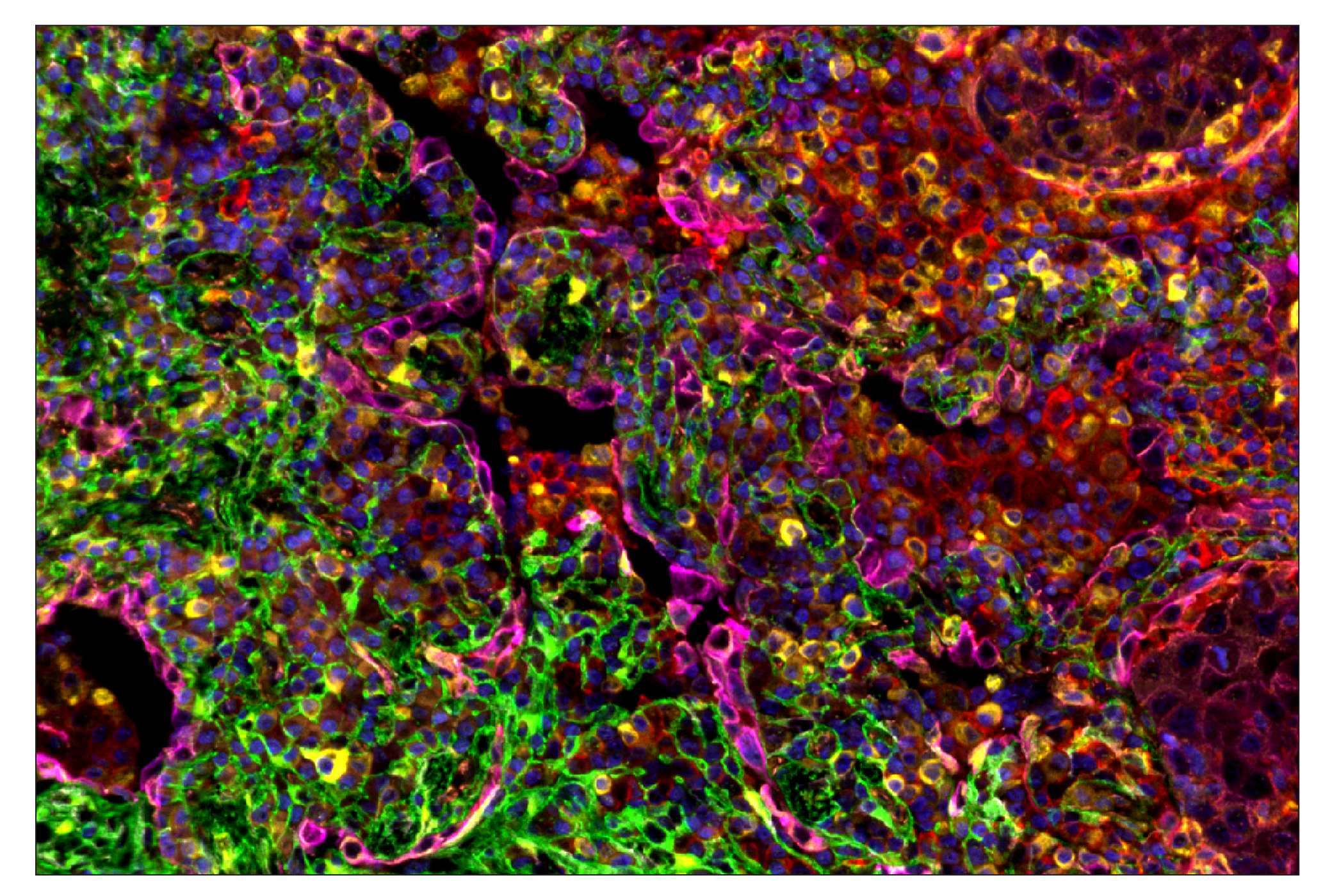 Immunohistochemistry Image 7: COL1A1 (E8F4L) & CO-0106-647 SignalStar™ Oligo-Antibody Pair