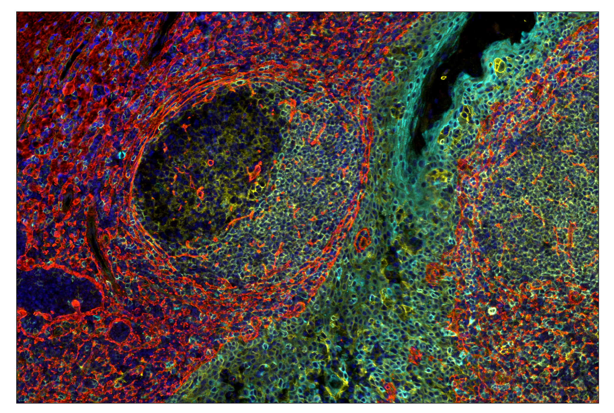 Immunohistochemistry Image 8: COL1A1 (E8F4L) & CO-0106-647 SignalStar™ Oligo-Antibody Pair