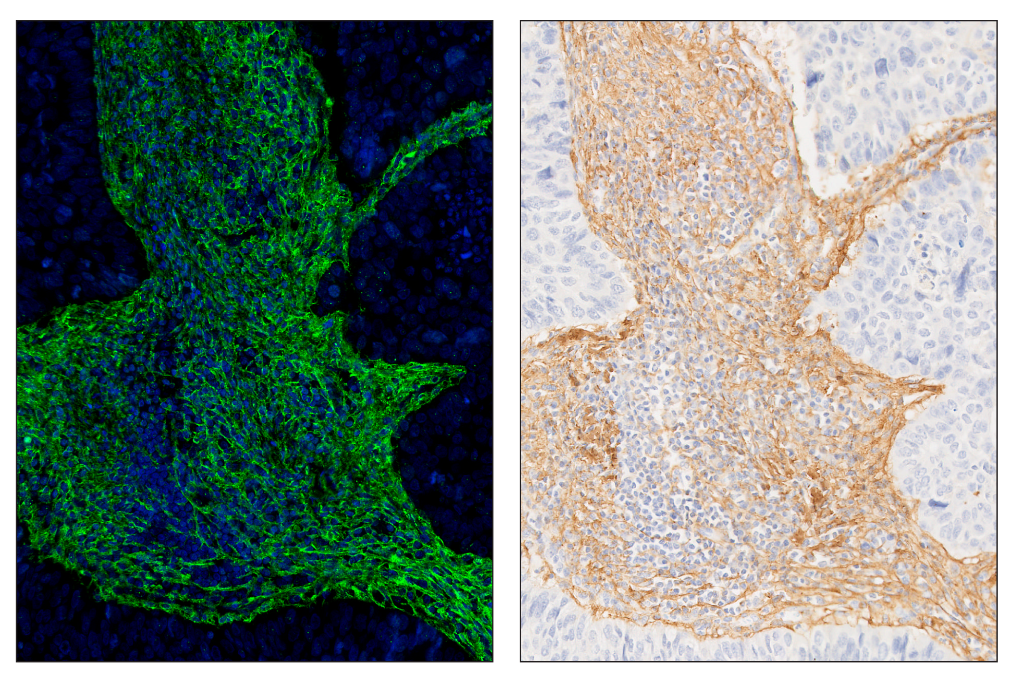 Immunohistochemistry Image 6: COL1A1 (E8F4L) & CO-0106-647 SignalStar™ Oligo-Antibody Pair