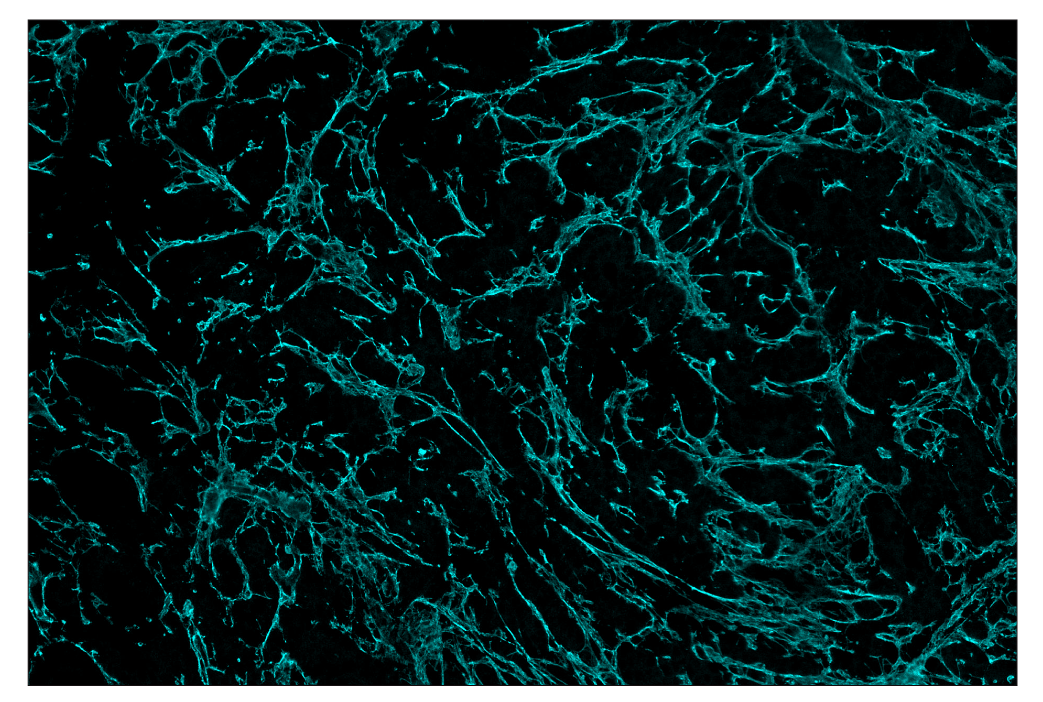 Immunohistochemistry Image 5: COL1A1 (E8F4L) & CO-0106-647 SignalStar™ Oligo-Antibody Pair