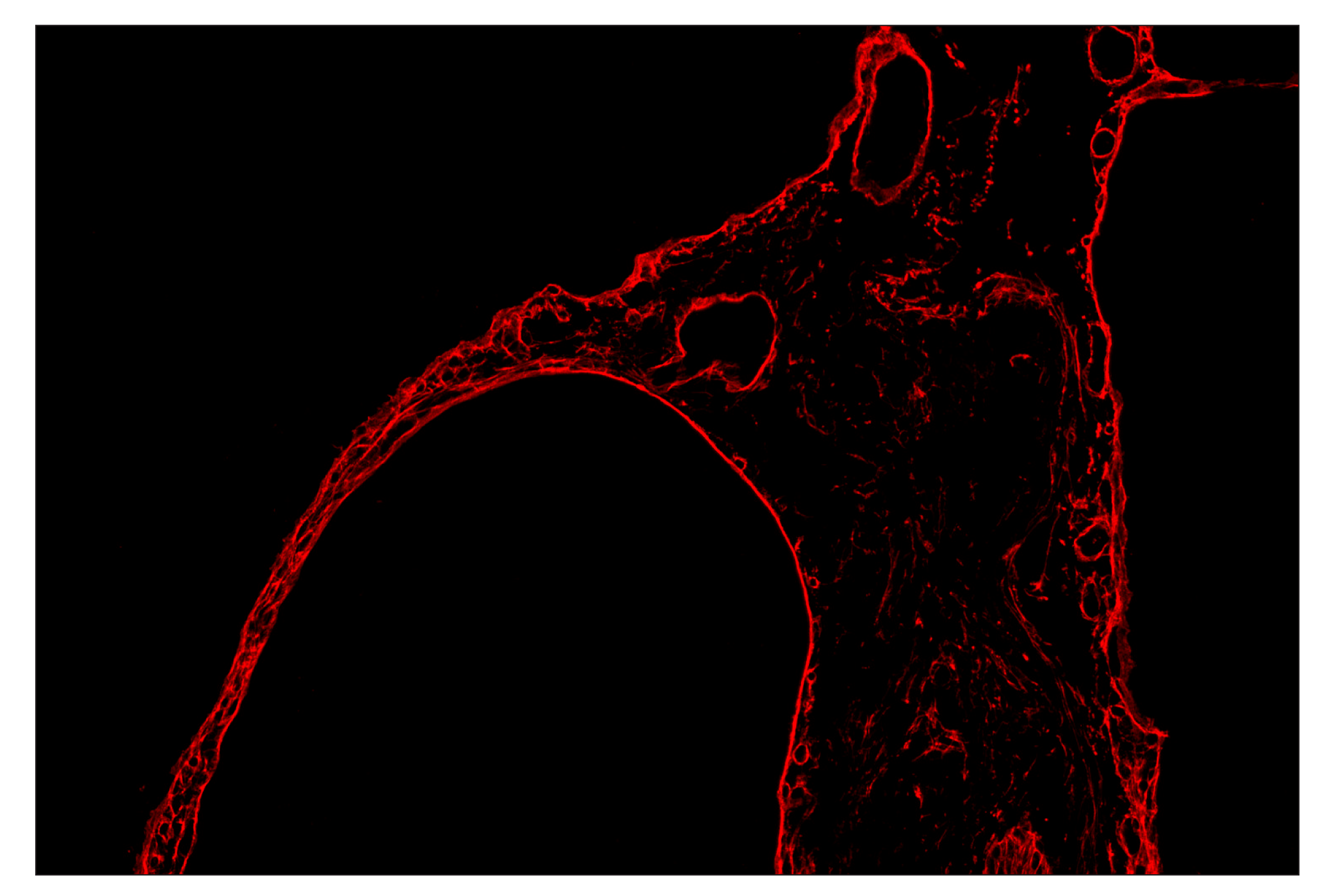 Immunohistochemistry Image 4: COL1A1 (E8F4L) & CO-0106-647 SignalStar™ Oligo-Antibody Pair