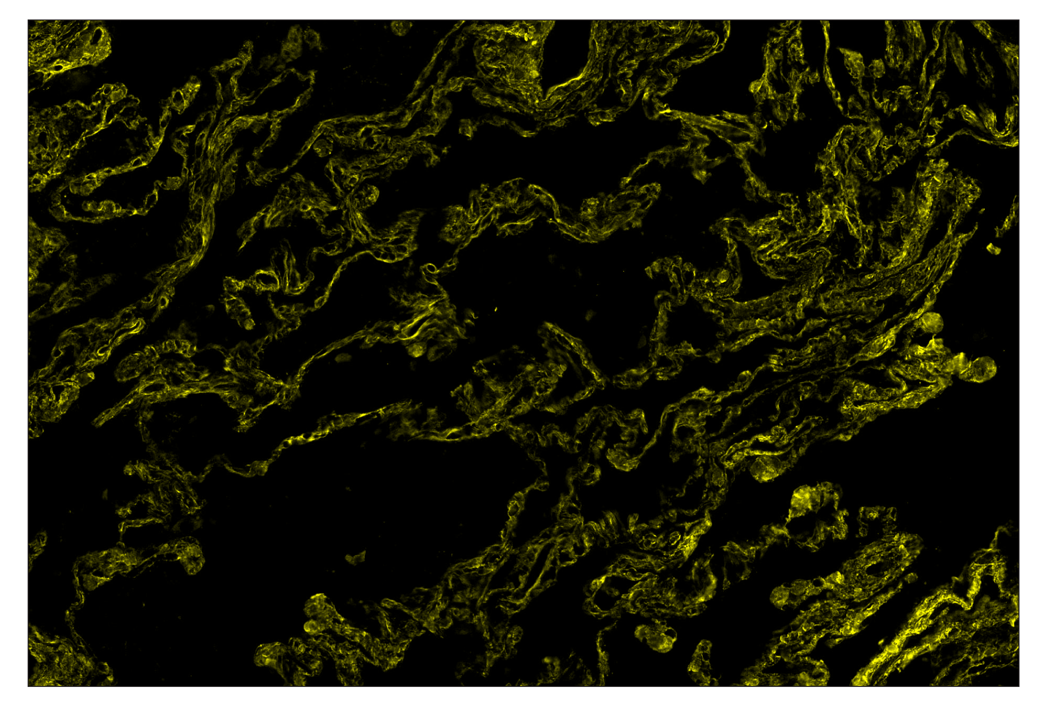 Immunohistochemistry Image 3: COL1A1 (E8F4L) & CO-0106-647 SignalStar™ Oligo-Antibody Pair