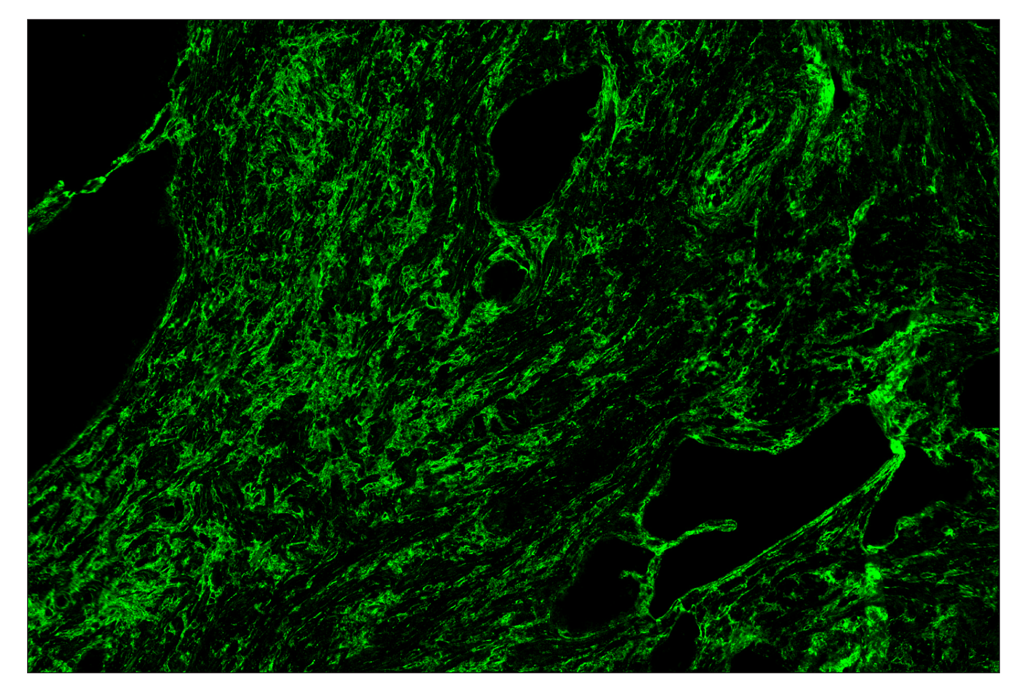 Immunohistochemistry Image 2: COL1A1 (E8F4L) & CO-0106-647 SignalStar™ Oligo-Antibody Pair