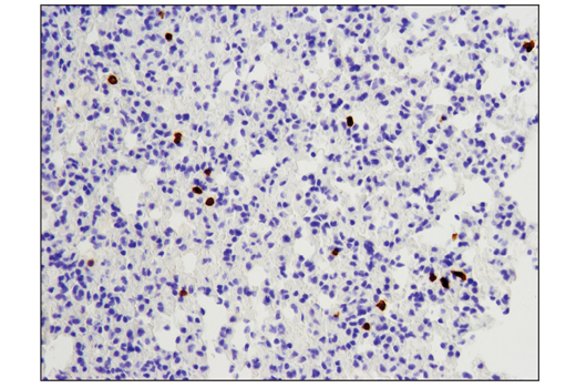 Immunohistochemistry Image 1: CD8α (D4W2Z) XP® Rabbit mAb (Mouse Specific)