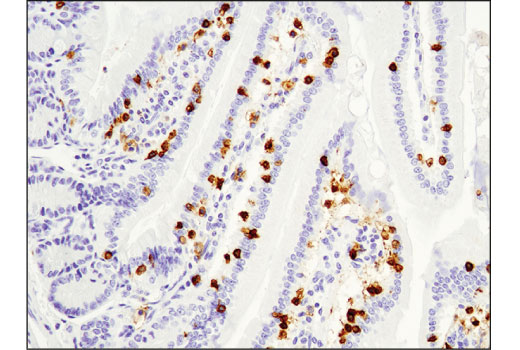Immunohistochemistry Image 3: CD8α (D4W2Z) XP® Rabbit mAb (Mouse Specific)