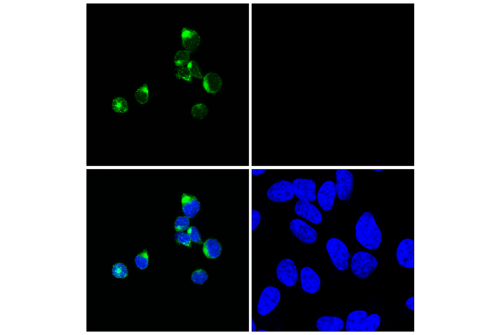 Immunofluorescence Image 1: Granzyme K (E6Z6O) Rabbit mAb