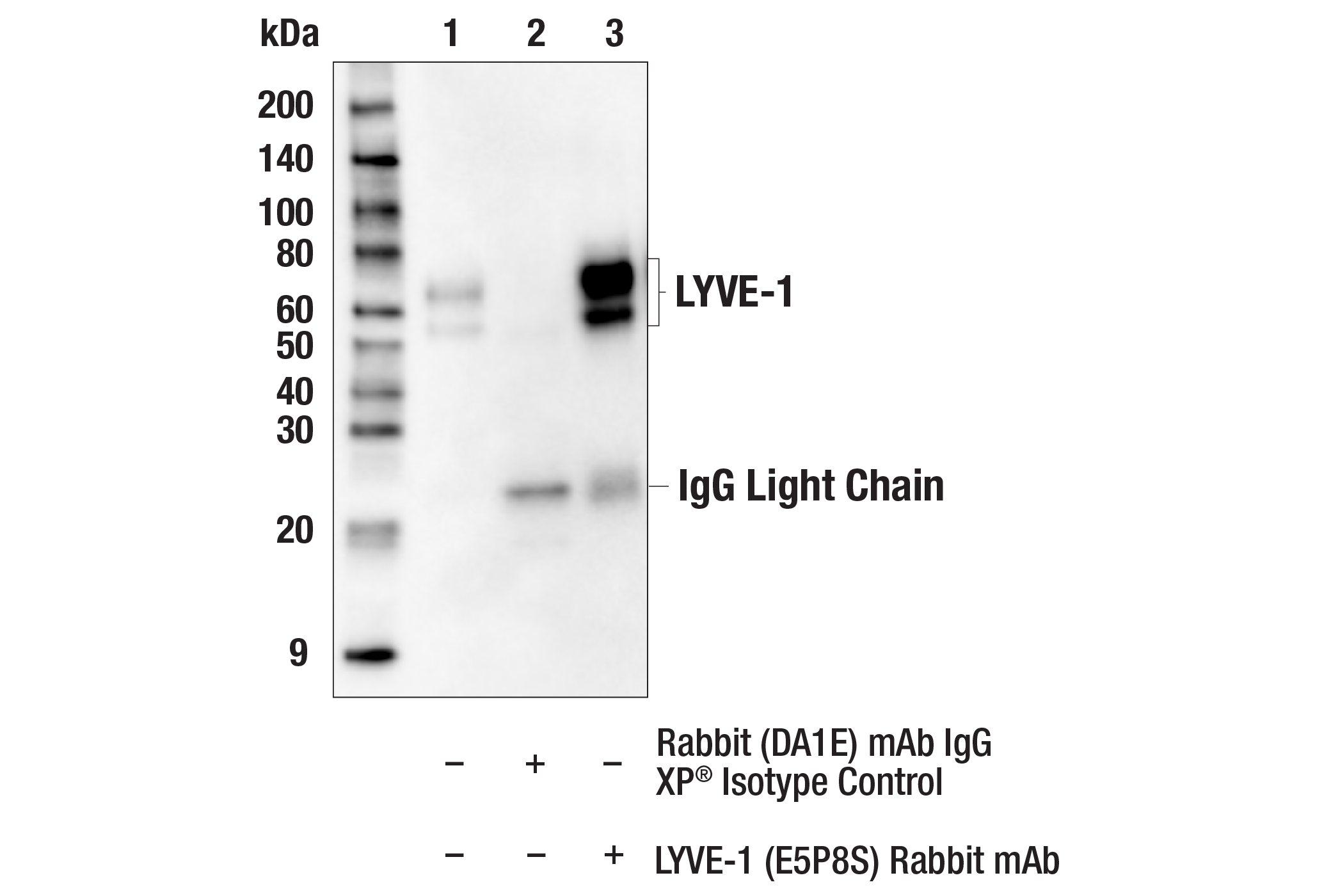 Immunoprecipitation Image 1: LYVE-1 (E5P8S) Rabbit mAb