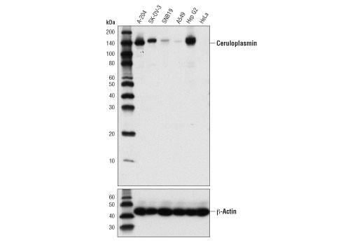 Western Blotting Image 1: Ceruloplasmin (D7Q5W) Rabbit mAb