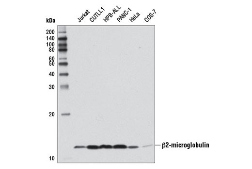 Western Blotting Image 2: β2-microglobulin Antibody