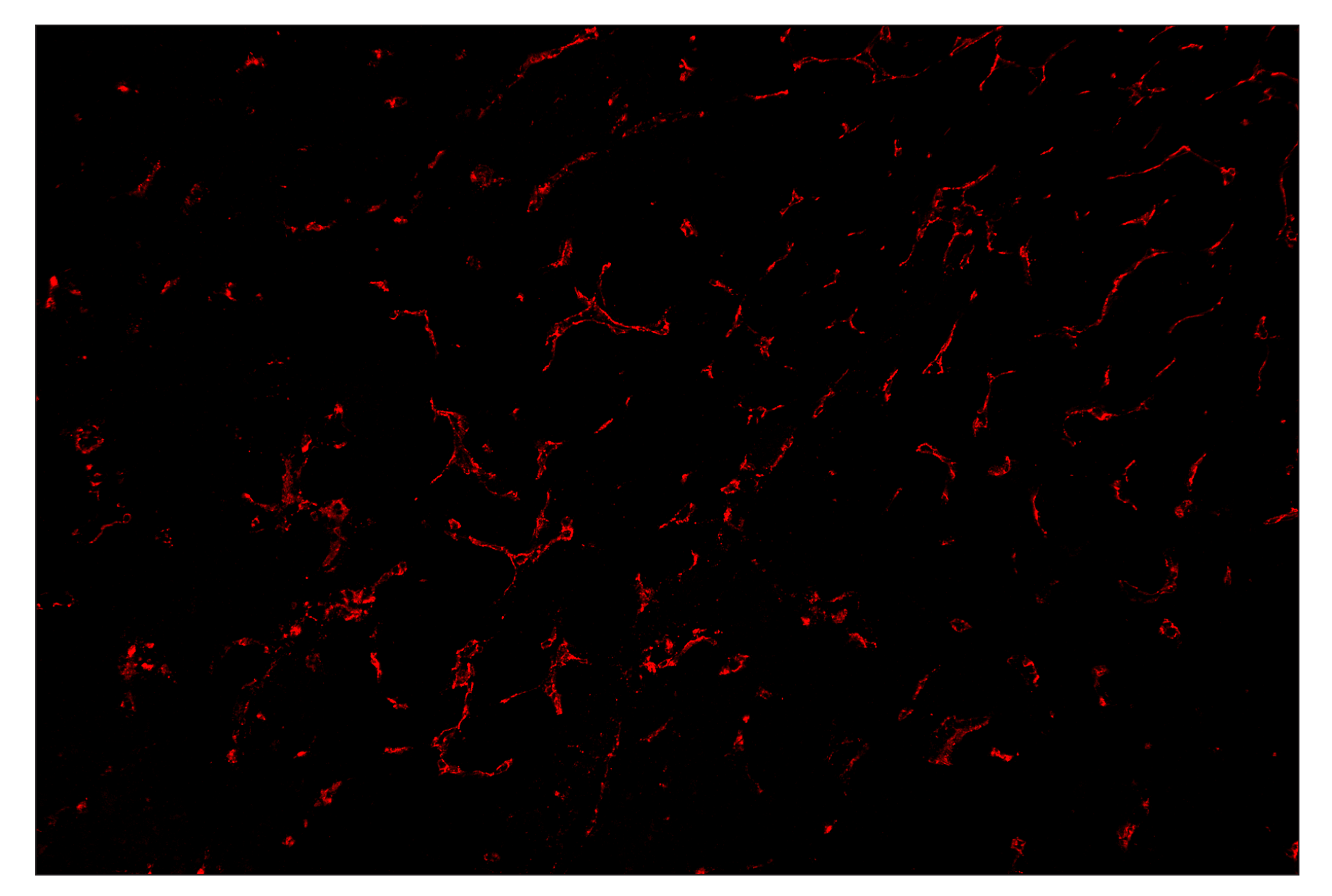 Immunohistochemistry Image 4: CD31 (PECAM-1) (D8V9E) & CO-0050-594 SignalStar™ Oligo-Antibody Pair