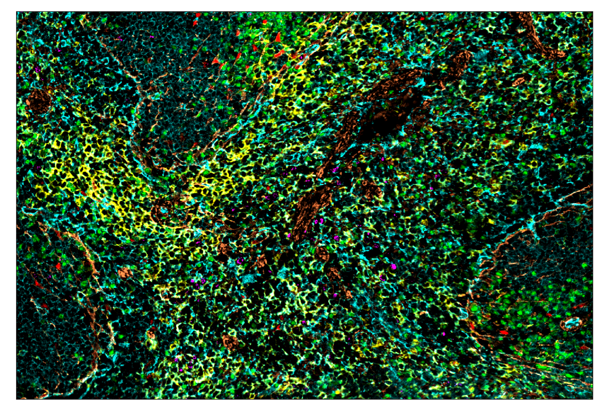 Immunohistochemistry Image 1: CD31 (PECAM-1) (D8V9E) & CO-0050-488 SignalStar™ Oligo-Antibody Pair