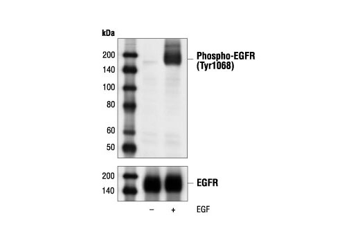  Image 1: Epidermal Growth Factor (Human EGF)