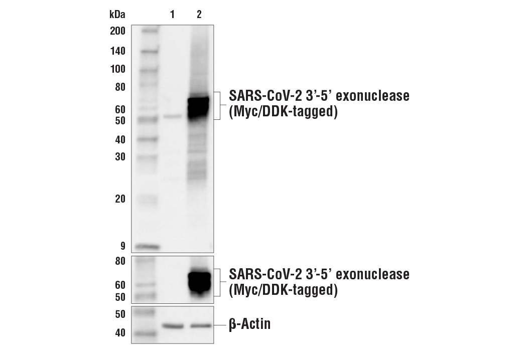 Western Blotting Image 1: SARS-CoV-2 3’-5’ Exonuclease Antibody