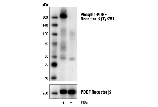  Image 1: Platelet-Derived Growth Factor (PDGF)