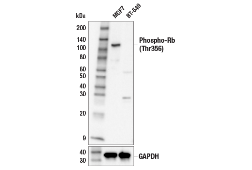 Western Blotting Image 2: Phospho-Rb (Thr356) Antibody