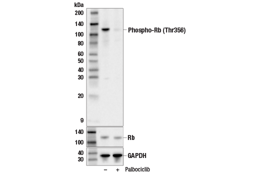 Western Blotting Image 1: Phospho-Rb (Thr356) Antibody