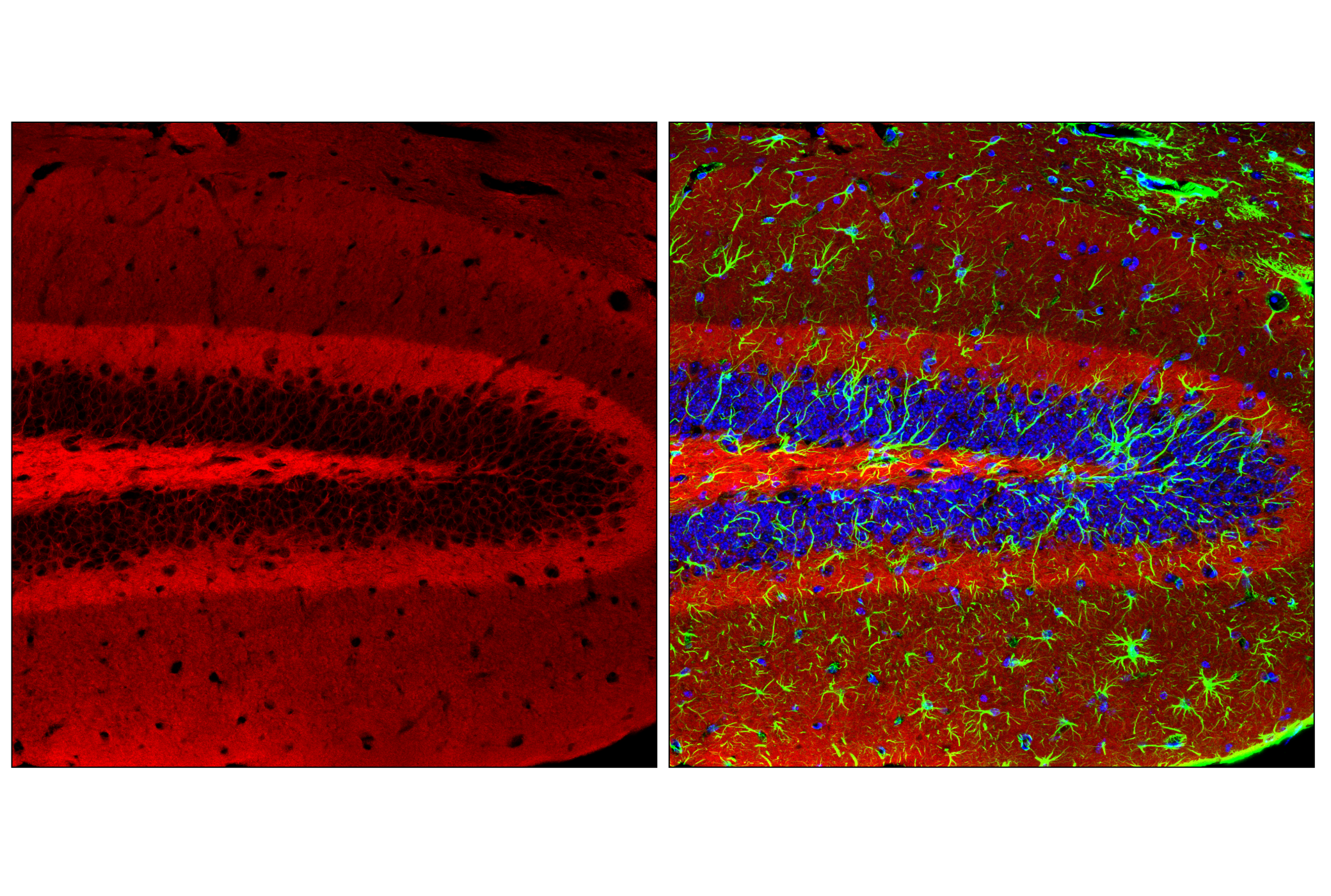 Immunofluorescence Image 1: NCAM1 (CD56) (E7X9M) XP® Rabbit mAb (Alexa Fluor® 555 Conjugate)