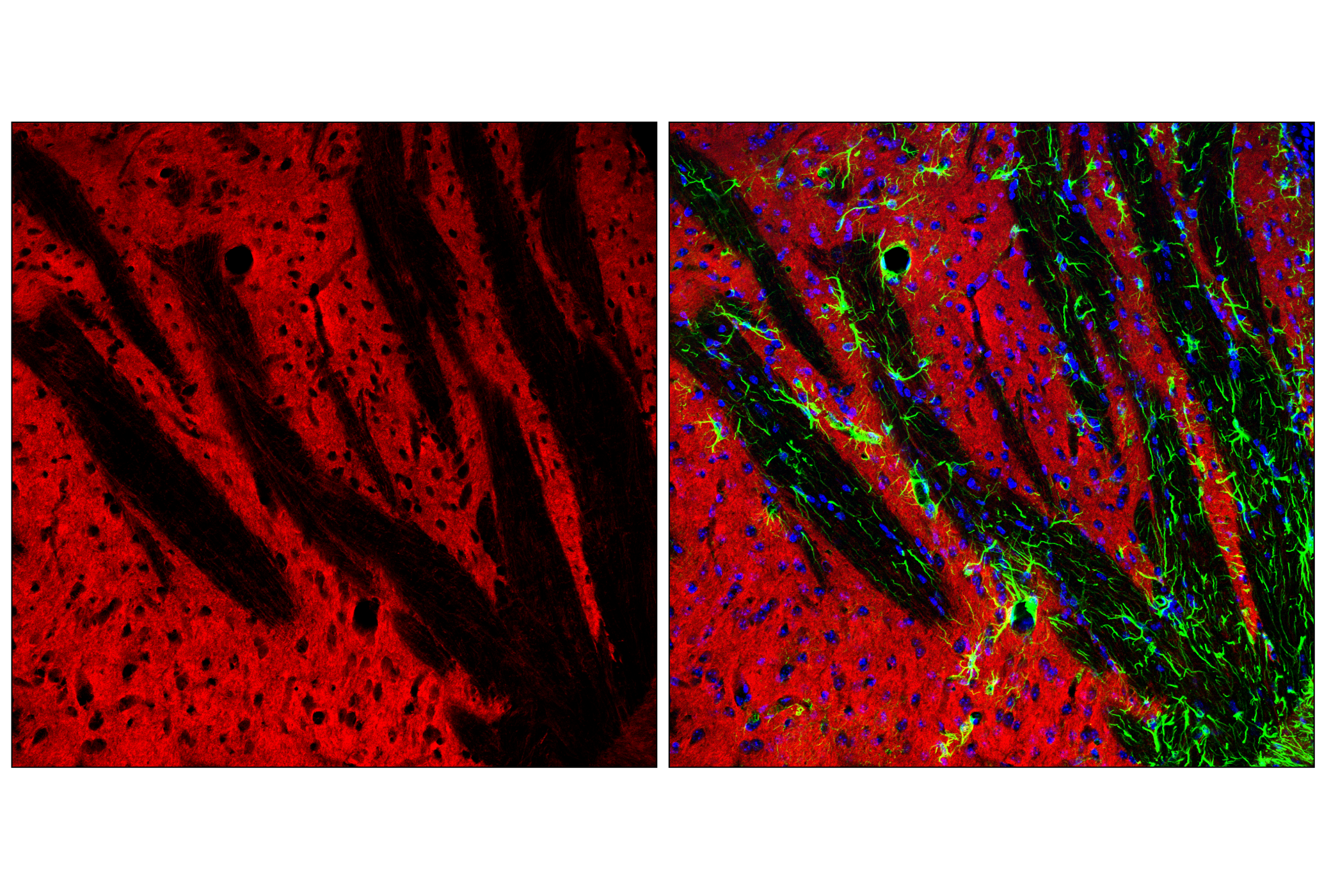 Immunofluorescence Image 2: NCAM1 (CD56) (E7X9M) XP® Rabbit mAb (Alexa Fluor® 555 Conjugate)