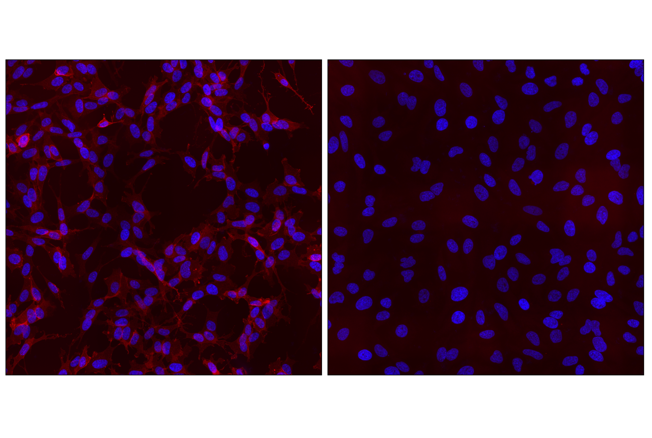 Immunofluorescence Image 3: NCAM1 (CD56) (E7X9M) XP® Rabbit mAb (Alexa Fluor® 555 Conjugate)