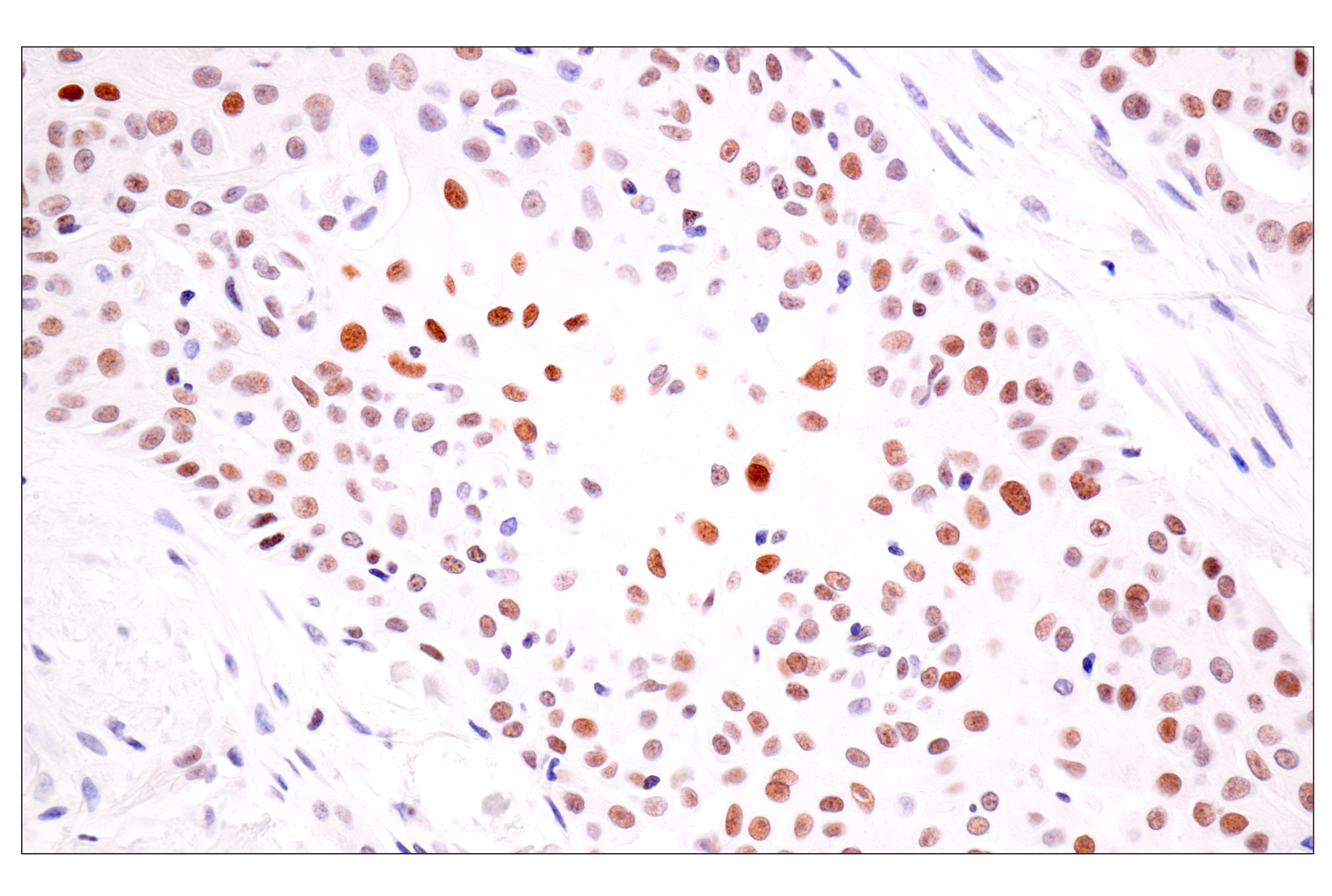 Immunohistochemistry Image 2: TLE3 (E4F3Y) Rabbit mAb